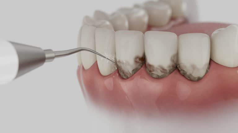 Reliable Dental Implants contractor in Wayne County County, UT by Dentist Open Now